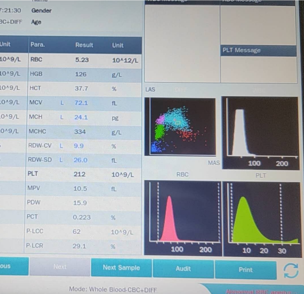 EM7100P Hematology Analyzer: Smart Aperture Voltage Control Technology